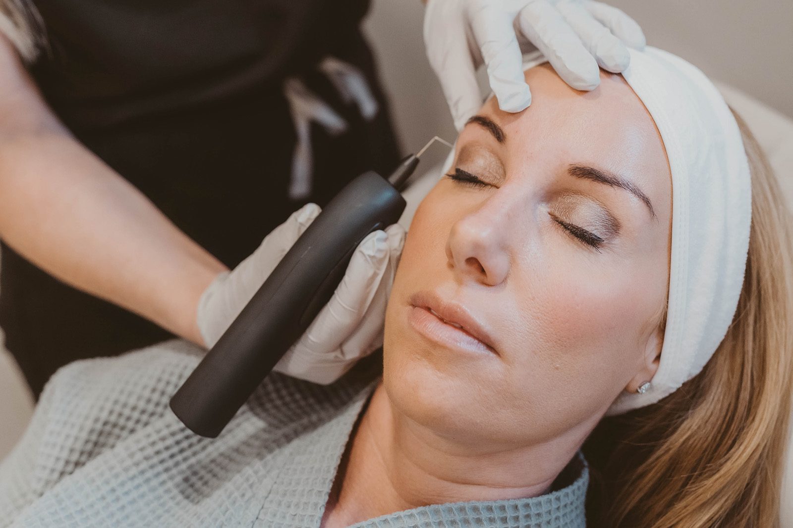fibroblasting