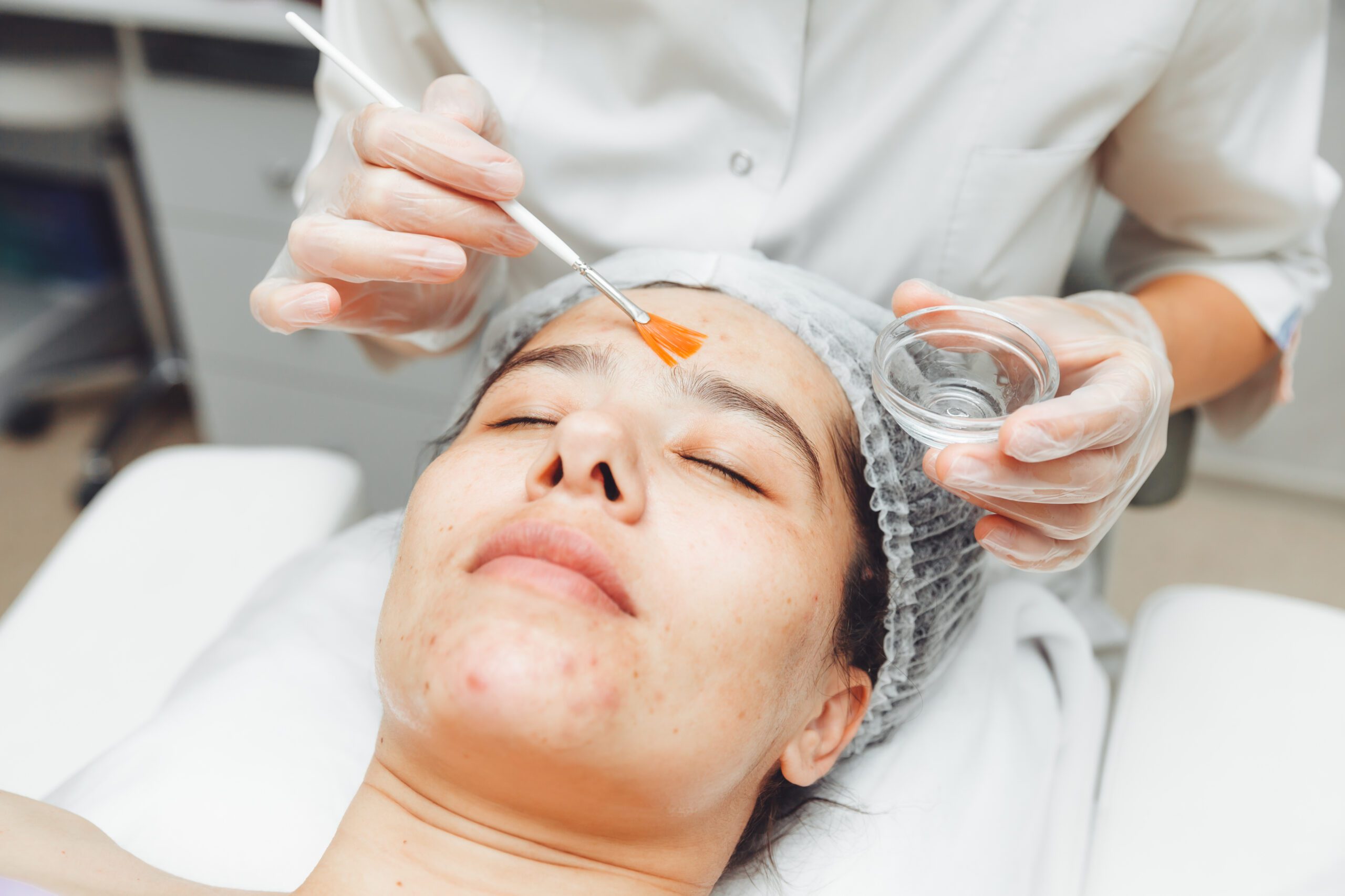 Skin care services